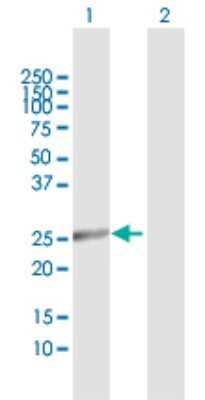 Western Blot: DCI Antibody [H00001632-D01P]