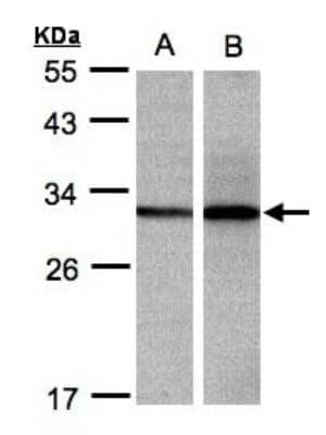 Western Blot: DCI Antibody [NBP1-31549]