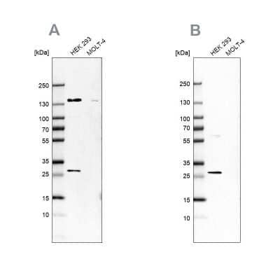 Western Blot: DCI Antibody [NBP1-91821]