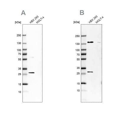 Western Blot: DCI Antibody [NBP1-91822]