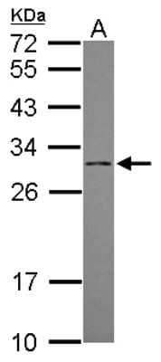 Western Blot: DCI Antibody [NBP2-16107]