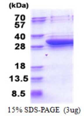 SDS-PAGE: Recombinant Human DCI His Protein [NBP2-23023]