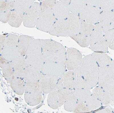 Immunohistochemistry-Paraffin: DCIR/CLEC4A Antibody [NBP1-84446]
