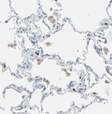 Immunohistochemistry-Paraffin: DCIR/CLEC4A Antibody [NBP1-84446]