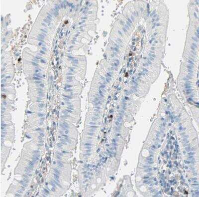 Immunohistochemistry-Paraffin: DCIR/CLEC4A Antibody [NBP1-84446]