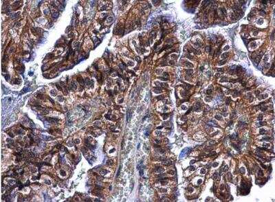 Immunohistochemistry-Paraffin: DCIR/CLEC4A Antibody [NBP2-15916]