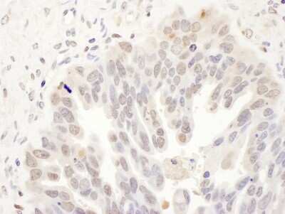 Immunohistochemistry: DCK Antibody [NBP2-32179]
