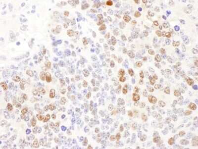 Immunohistochemistry: DCK Antibody [NBP2-32179]