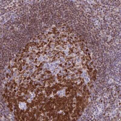 Immunohistochemistry: DCK Antibody [NBP2-38972]