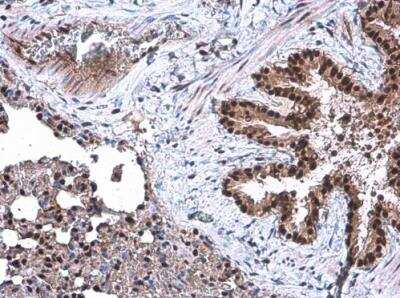 Immunohistochemistry-Paraffin: DCK Antibody [NBP2-16108]