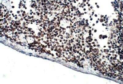 Immunohistochemistry-Paraffin: DCK Antibody [NBP3-12297]