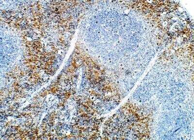 Immunohistochemistry-Paraffin: DCK Antibody [NBP3-12297]