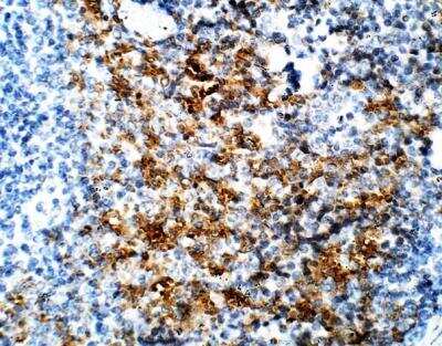 Immunohistochemistry-Paraffin: DCK Antibody [NBP3-12297]