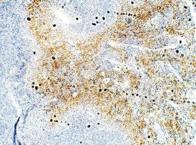 Immunohistochemistry-Paraffin: DCK Antibody [NBP3-12297]