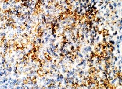 Immunohistochemistry-Paraffin: DCK Antibody [NBP3-12297]