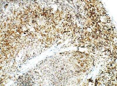 Immunohistochemistry-Paraffin: DCK Antibody [NBP3-12297]