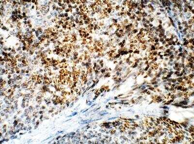 Immunohistochemistry-Paraffin: DCK Antibody [NBP3-12297]