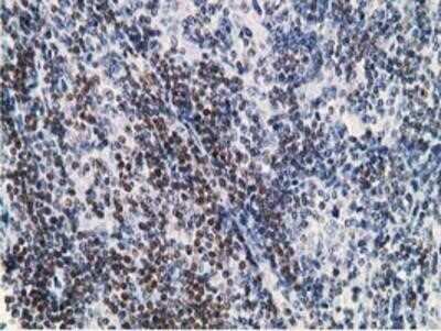 Immunohistochemistry: DCK Antibody (OTI3F5) - Azide and BSA Free [NBP2-70555]