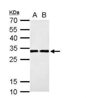 Western Blot: DCK Antibody [NBP2-16108]