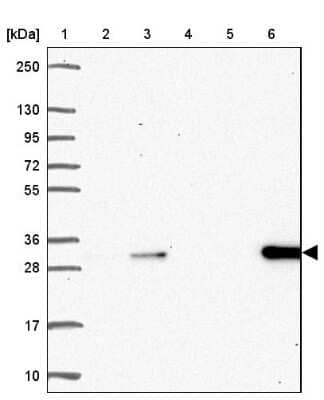 Western Blot: DCK Antibody [NBP2-38972]