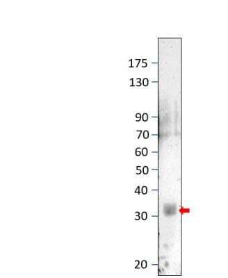 Western Blot: DCK Antibody [NBP3-12297]