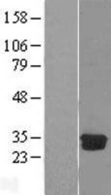 Western Blot: DCK Overexpression Lysate [NBL1-09740]