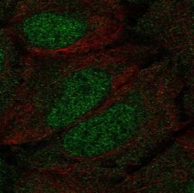 Immunocytochemistry/ Immunofluorescence: DCLK1 Antibody [NBP2-58700]