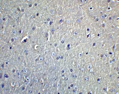 Immunohistochemistry: DCLK1 Antibody - BSA Free [NBP1-77127]