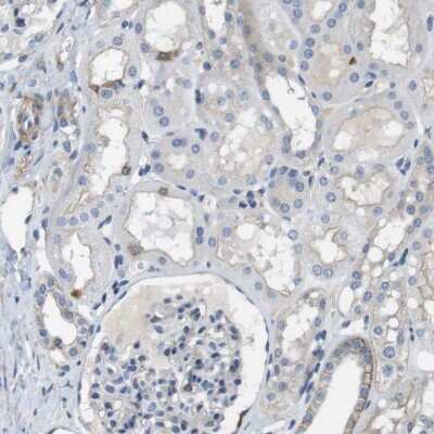 Immunohistochemistry-Paraffin: DCLK1 Antibody [NBP2-48530]
