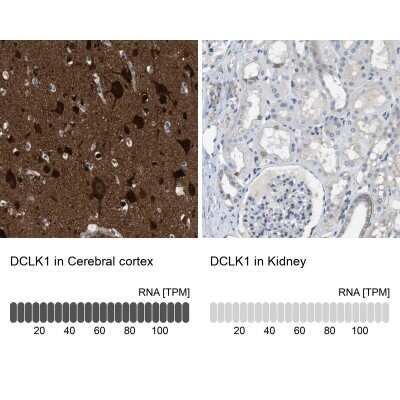 Immunohistochemistry-Paraffin: DCLK1 Antibody [NBP2-48530]