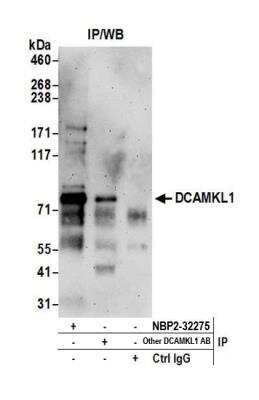 Immunoprecipitation: DCLK1 Antibody [NBP2-36420]