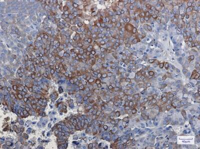 Immunohistochemistry-Paraffin: DCLK1 Antibody (S05-8D6) [NBP3-19952]