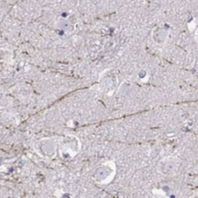 Immunohistochemistry: DCLK3 Antibody [NBP2-68640]