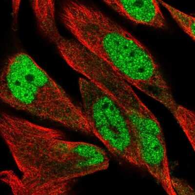 Immunocytochemistry/ Immunofluorescence: DCLRE1B Antibody [NBP2-57379]