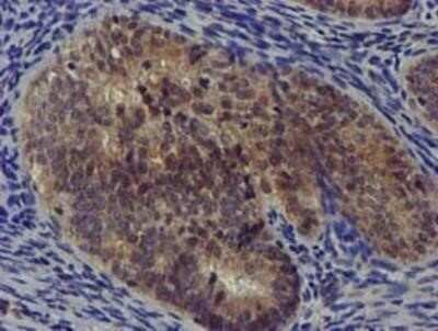Immunohistochemistry: DCLRE1B Antibody (OTI2B7) - Azide and BSA Free [NBP2-72152]