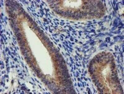 Immunohistochemistry: DCLRE1B Antibody (OTI2B7) - Azide and BSA Free [NBP2-72152]