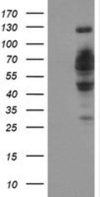 Western Blot: DCLRE1B Antibody (OTI2B7)Azide and BSA Free [NBP2-72152]