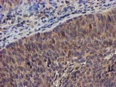 Immunohistochemistry-Paraffin: DCLRE1B Antibody (OTI2B7) [NBP2-03563]
