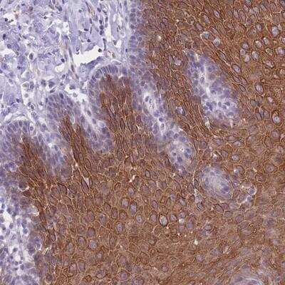 Immunohistochemistry-Paraffin: DCNP1 Antibody [NBP2-14415]