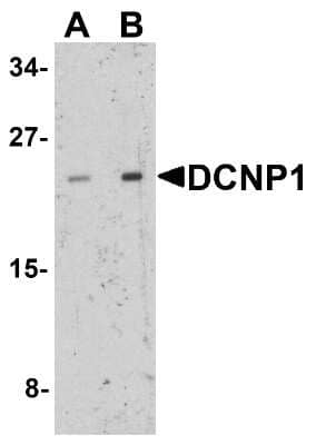 Western Blot: DCNP1 AntibodyBSA Free [NBP2-81911]