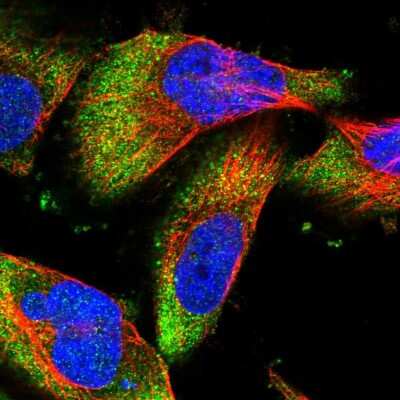 Immunocytochemistry/ Immunofluorescence: DCP1B Antibody [NBP1-82018]