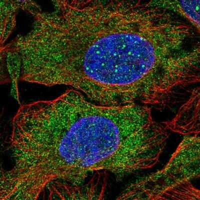 Immunocytochemistry/ Immunofluorescence: DCP1B Antibody [NBP2-55470]