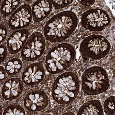 Immunohistochemistry-Paraffin: DCP1B Antibody [NBP1-82018]