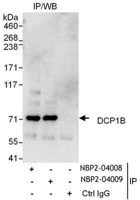 Immunoprecipitation: DCP1B Antibody [NBP2-04008]