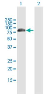 Western Blot: DCP1B Antibody [H00196513-B01P]