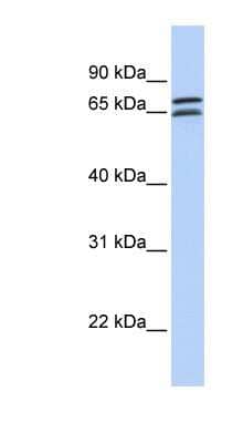 Western Blot: DCP1B Antibody [NBP1-79422]