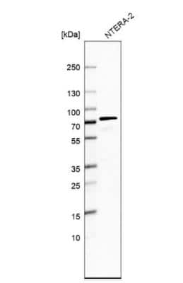 Western Blot: DCP1B Antibody [NBP1-82018]