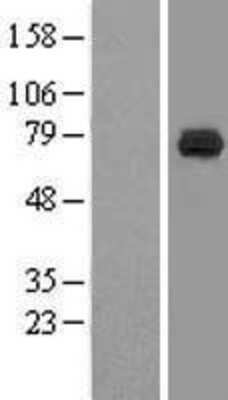 Western Blot: DCP1B Overexpression Lysate [NBL1-09746]