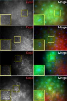 Immunocytochemistry/ Immunofluorescence: DCP2 Antibody [NBP2-16109]