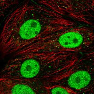 Immunocytochemistry/ Immunofluorescence: DCP2 Antibody [NBP2-56996]